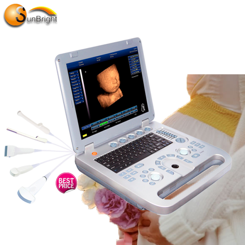 УЗД щитовидної залози. Найдешевший портативний 3D-УЗД HD 3D