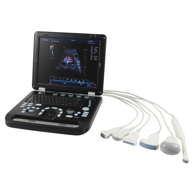 Factory price portable 3D 4d echocardiography ultrasound USG