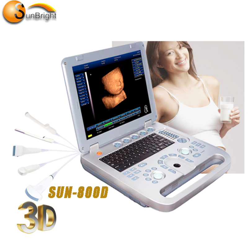 portable laptop ultrasound scanner linear/convex PC platform ultrasound scanning system