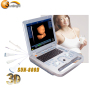 portable laptop ultrasound scanner linear/convex PC platform ultrasound scanning system