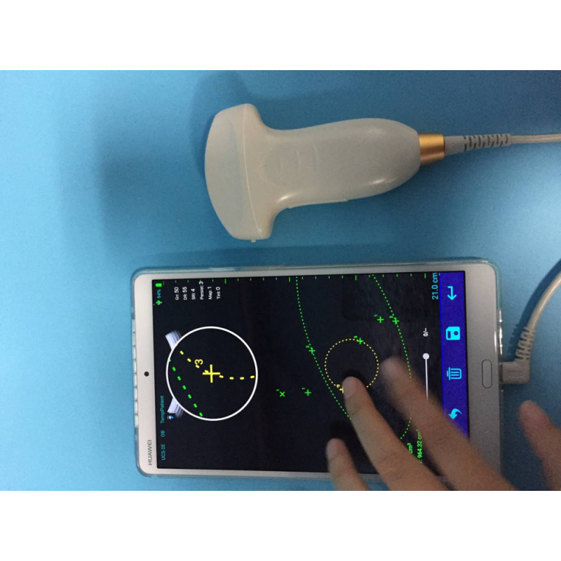 Factory price ultrasound 2D smartphone USB type-C convex probe for laptop