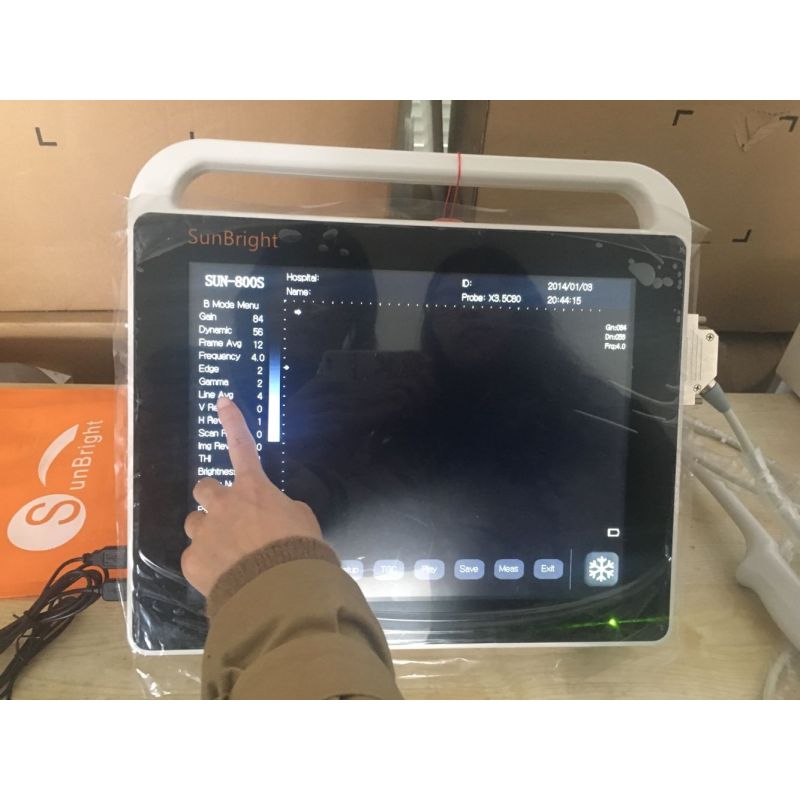 buy VET 15 inch laptop touch screen ultrasound machines convex probe