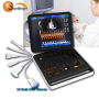 buy ultrasound machines phased array probe 4D CW pregnancy cardiac color Doppler