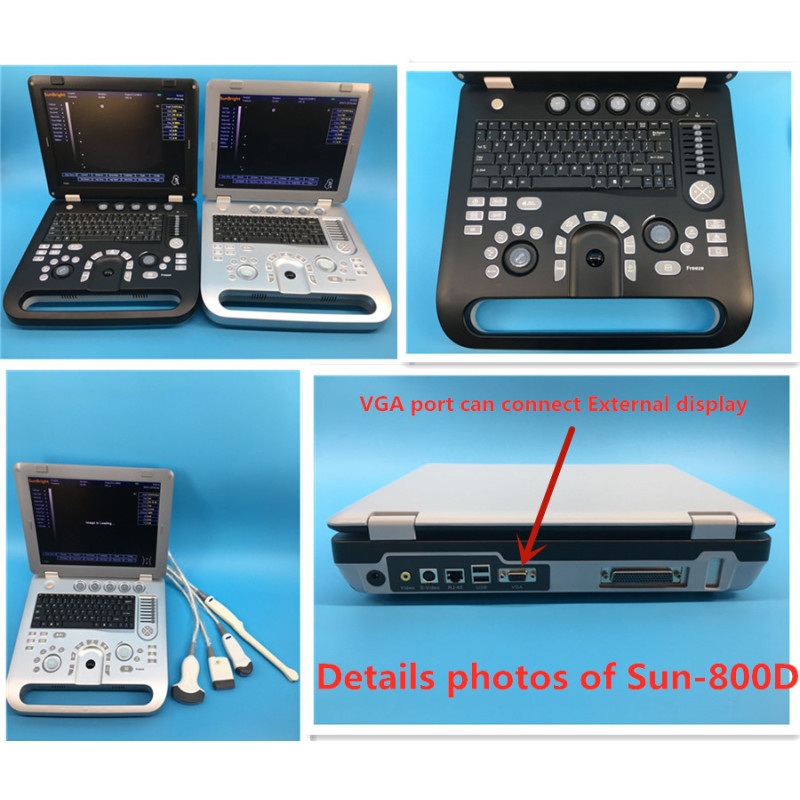 Portable laptop style Medical ecografo 3D ultrasound scanning machine 3D ultrasound scanner