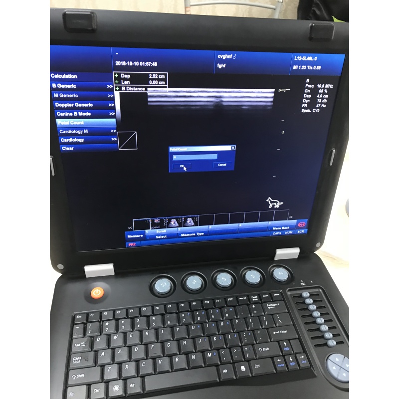 Sun-906A china hersteller 3d tragbare farbe doppler laptop ultraschall maschine für menschliche