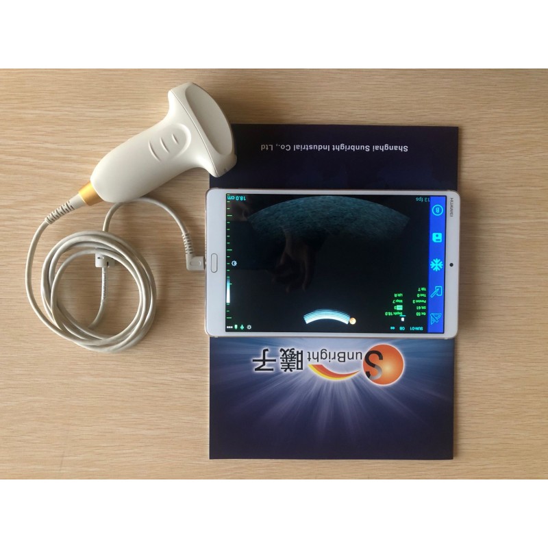 Doppler Probe Ultrasound Device scanner Ultrasound USB Convex Probe For android