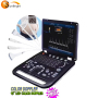 Best price Ecografo ultrasound 3d 4d dopler color Thyroid Testing Equipment SUN-906A