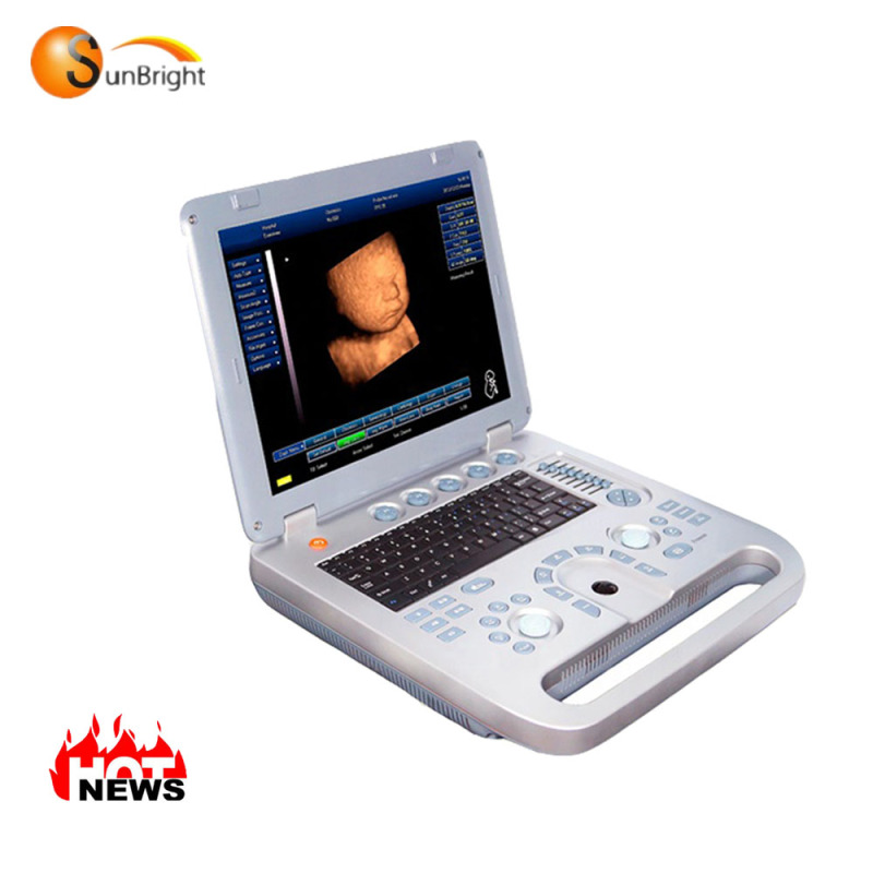 새로운 모델 4d 초음파 기계 최고의 가격과 품질