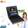 Medical hospital portable color doppler 4D ultrasonography machine