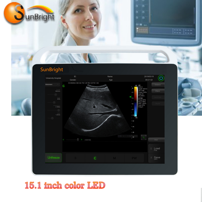 High end ultrasound machine and printer affordable ultrasound wifi linear
