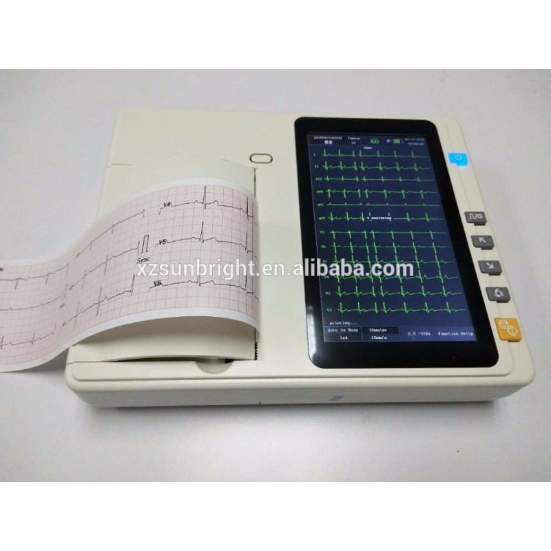 Portable mini size ECG machine 3 channel 12 lead acquisition with interpretation function