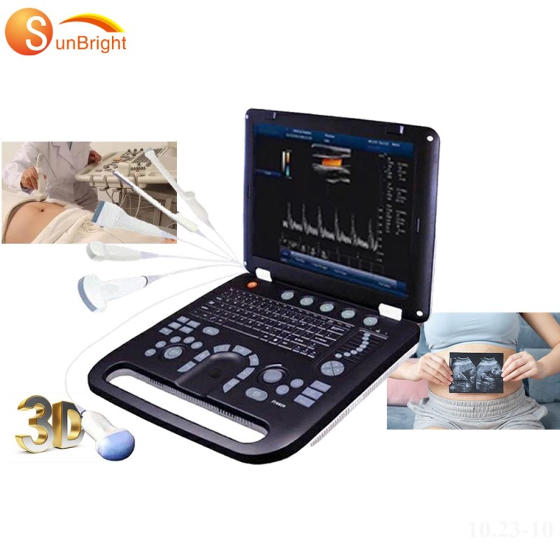 High resolution advanced 3D digital color ultrasound machine amazon