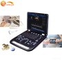 High resolution advanced 3D digital color ultrasound machine amazon