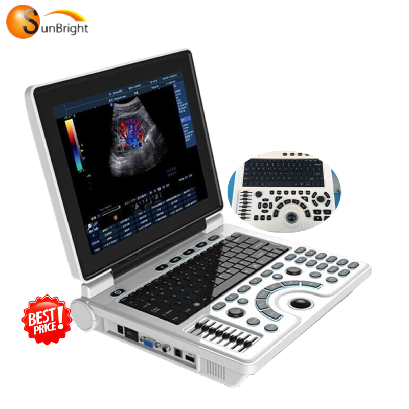 Portable LCD machine CE ultrasound scanner with top quality
