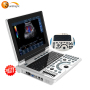 Portable LCD machine CE ultrasound scanner with top quality