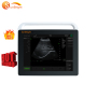 Medical examination scan ecografo Digital Portable Ultrasound