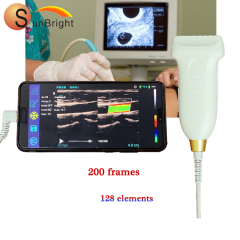 wifi clinic Doppler linear Type C probe ultrasound
