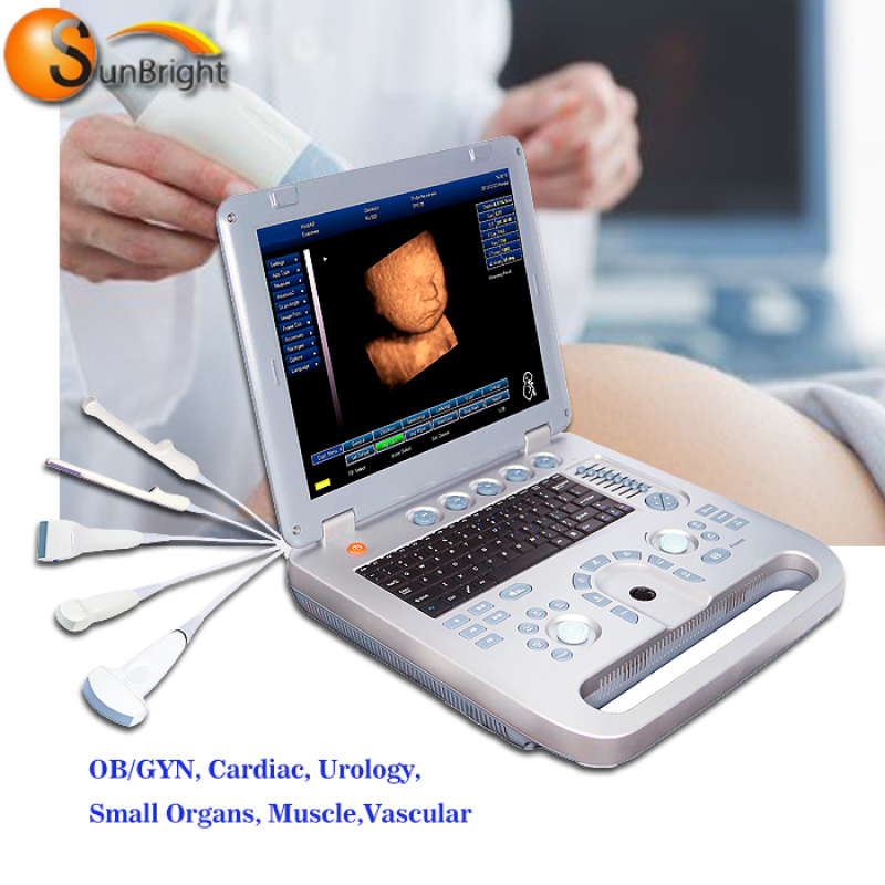 15 inches LCD Light Notebook 2D 3D China Portable Ultrasound Scan Machine mindray veterinary ultrasound