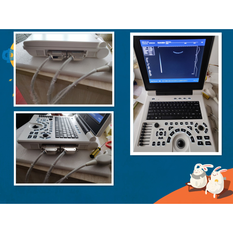 Portable LCD machine CE ultrasound scanner with top quality