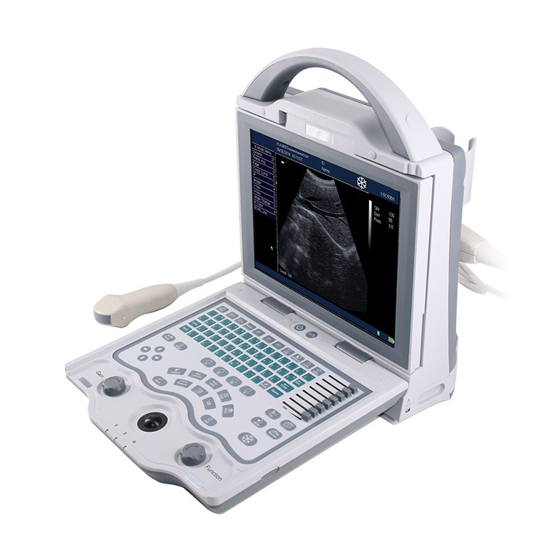 Portable LED Multi-language Ultrasound Machine SUN-800W