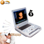 Portable Medical imaging Scanner USG Sonography Echo Ultrasonography Machines Ultrasound