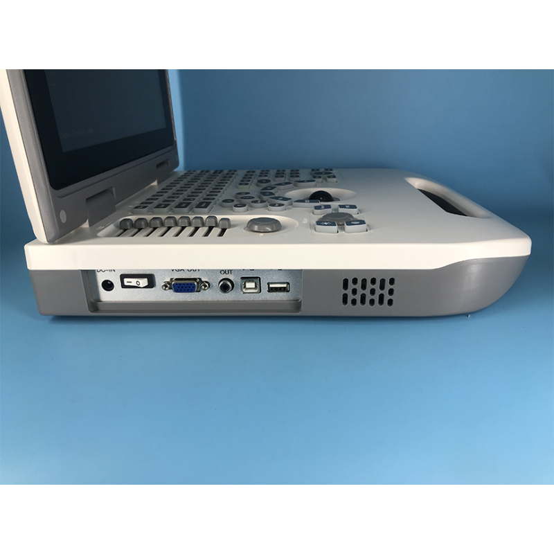 buy ultrasound Portable PC-based Convenient carry function ultrasound machine