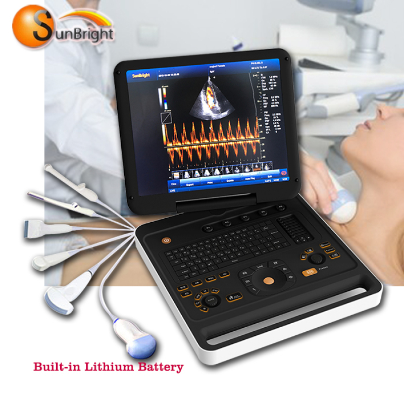 Portable Laptop 3D/4D CW Two Probe Connectors Gynecology Ultrasound Color Doppler Machine