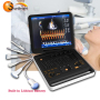 Portable Laptop 3D/4D CW Two Probe Connectors Gynecology Ultrasound Color Doppler Machine