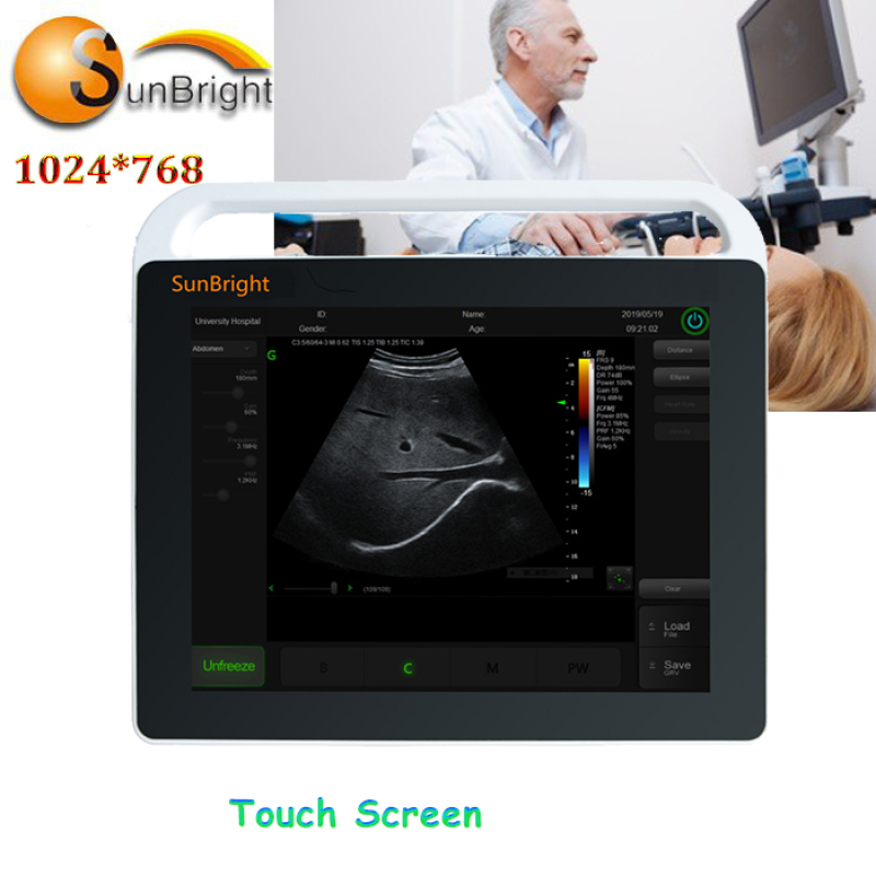 Portable CE hospital touch screen ultrasound machine type handheld cattle ultrasound color Doppler lower price