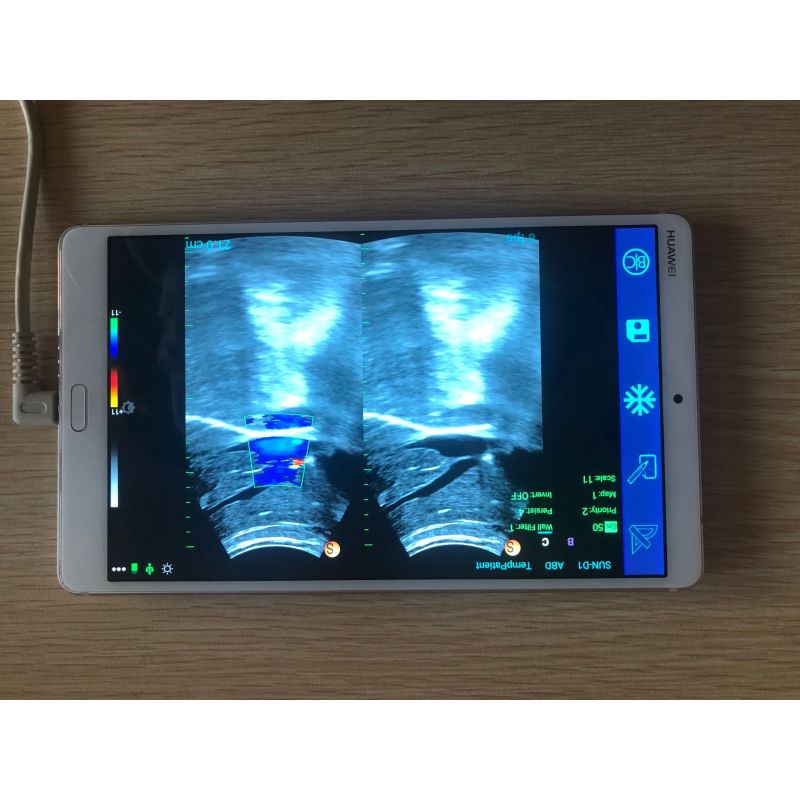 Best ultrasound machine wifi mini USB Convex probe