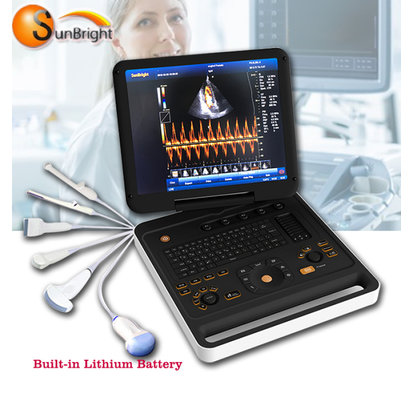 도플러 초음파 휴대용 저렴한 3D/4D CW 컬러 도플러 에코 초음파 기계 판매