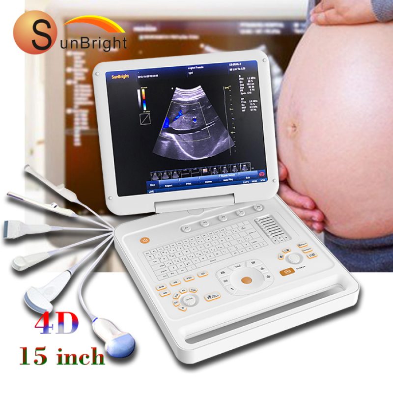 Medical hospital portable color Doppler 4D ultrasonography machine portable ultrasound