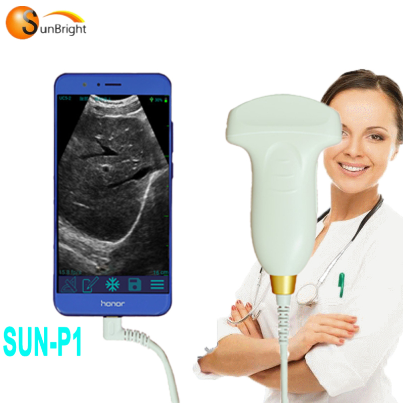 Big sale!!! Handheld USB convex probe mini ultrasound wireless probe