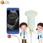 New USB Type-C ultrasound convex probe for android system