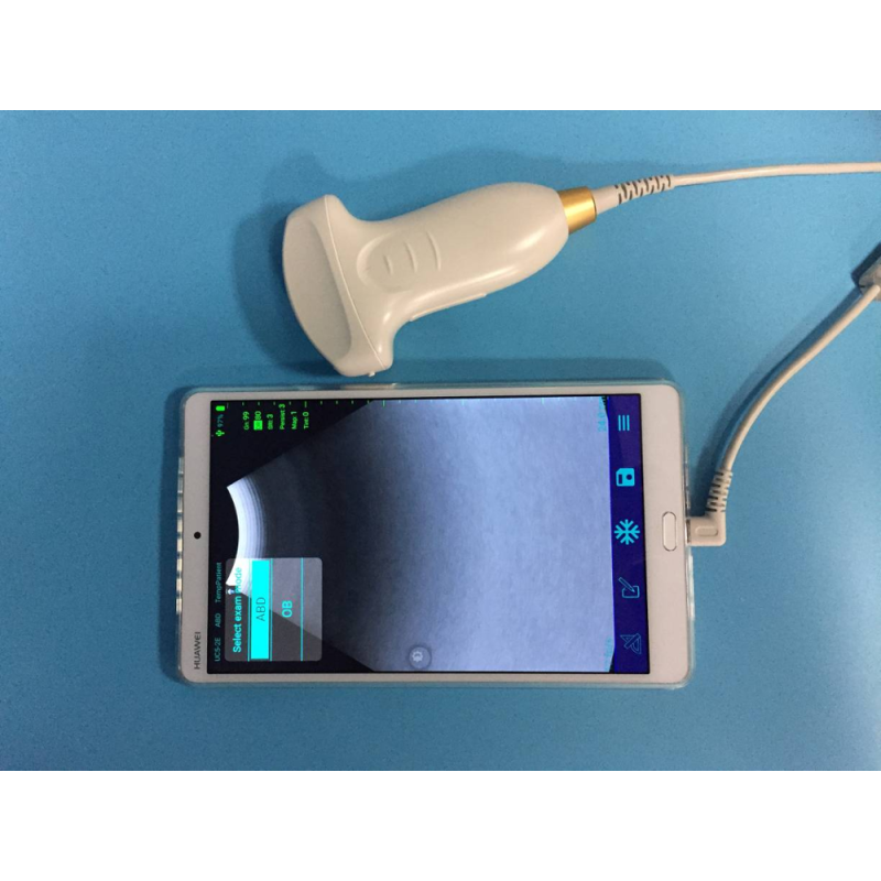 SUN-D1 prueba de embarazo color Doppler PW sonda convexa USB
