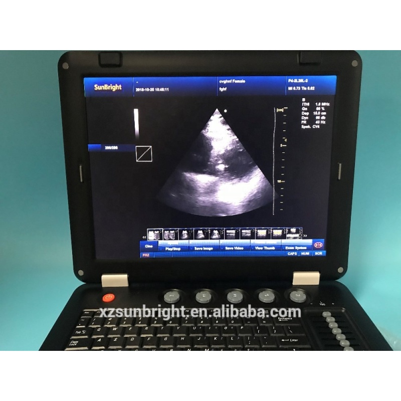 medical equipment 3D 4D Obstetrics color doppler ultrasound price