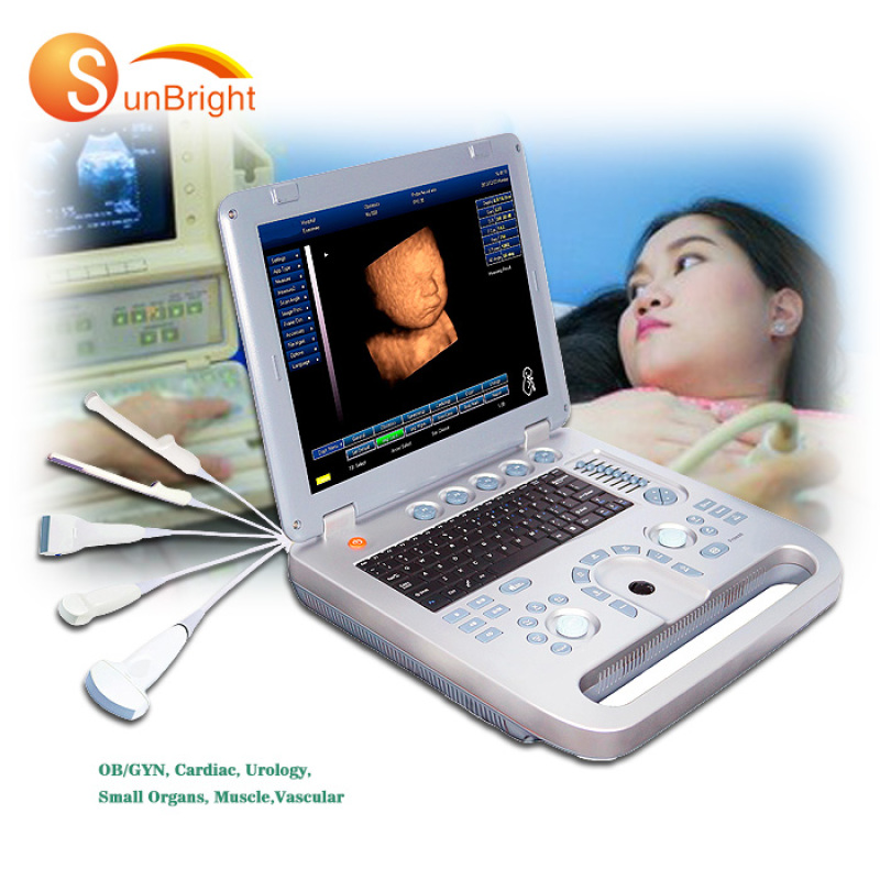 저렴한 Ecograph 휴대용 초음파 기계 초음파 스캐너 3D 컬러 초음파 기계 공장