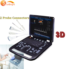 Vascular doppler ultrasonography machine 3D laptop full digital ultrasound