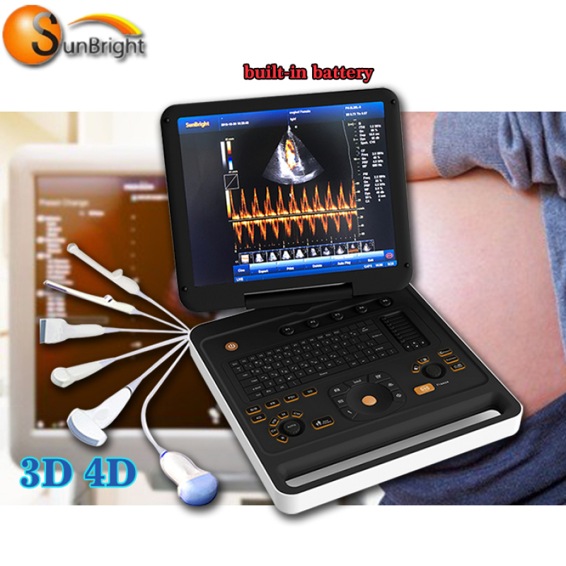 Medical hospital equipment Multi-Language Trolley 4D full digital Color Doppler ecografo