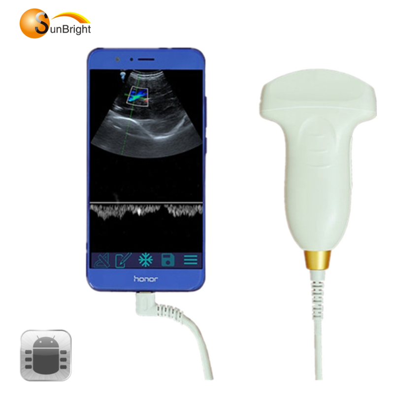 PW synchronous USB linear ultrasound system