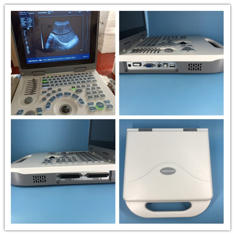 Best Warranty Ultrasound Machine Portable Notebook OB GYN Ultrasound Scanner
