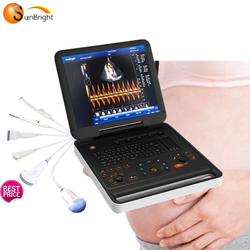 High quality hospital used pregency mobile portable 3D color doppler ultrasound machine