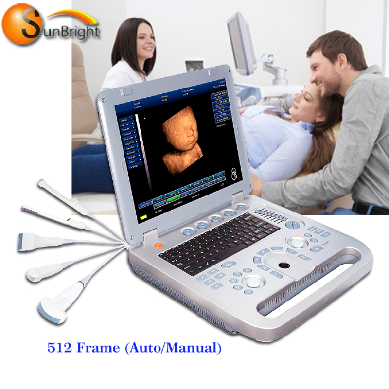 휴대용 수의학 초음파 노트북 3D 의료 시스템