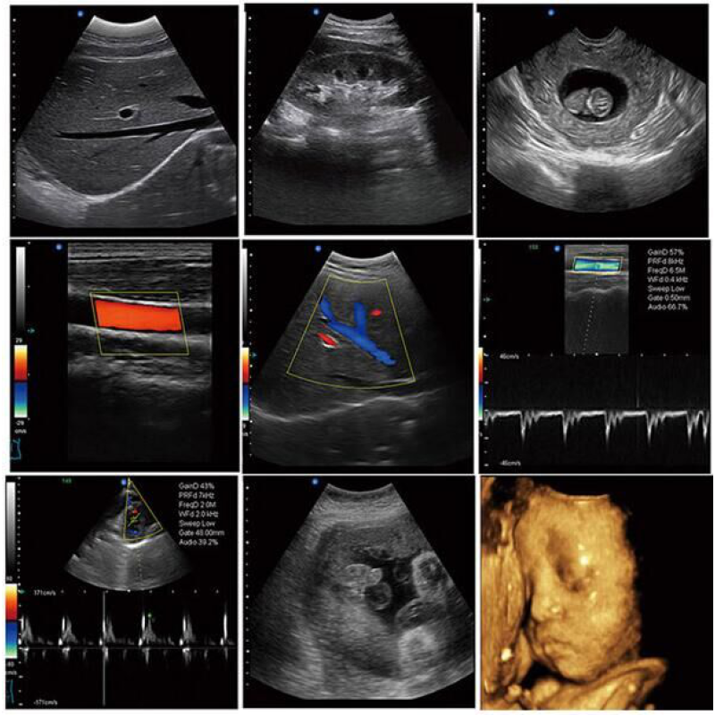 Portable 3D/4D CW CE SUN-906C Portable mindray color ultrasound portable doppler good quality