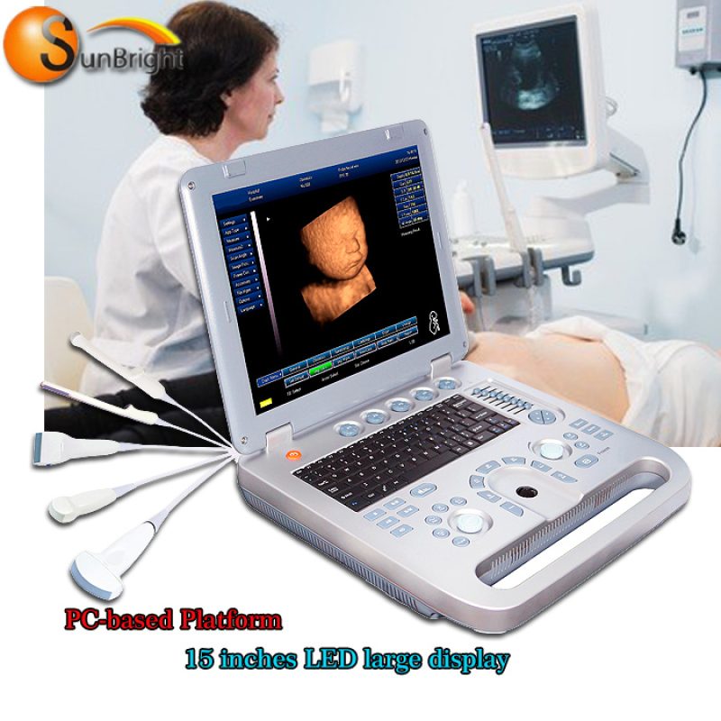 인간과 동물을 위한 고화질, 고품질 3D 스캐너 초음파