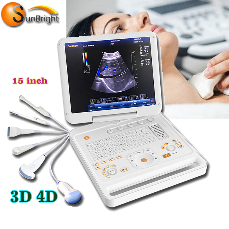SUN-906A Ultrasonido portátil 3D 4D Doppler color PC Escáner de ultrasonido Máquina de ultrasonido portátil Embarazo