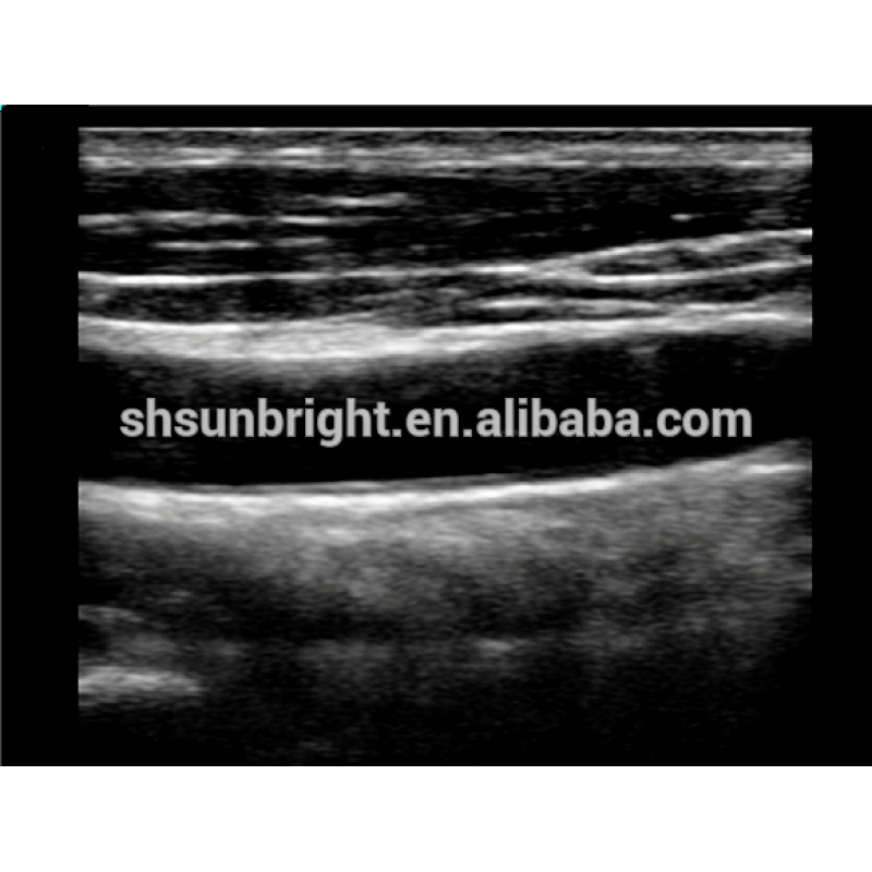 Factory price Portable ultrasound/USB wireless ultrasound probe bladder scan