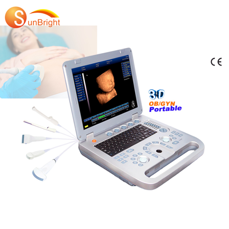 Machine à ultrasons pour ordinateur portable 15 pouces prix de gynécologie obstétrique