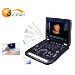 vascular color doppler scan PW portable ultrasound machine cost