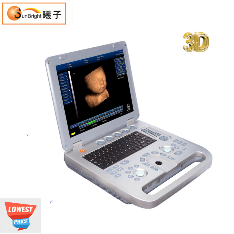 매우 우수한 3D 초음파 휴대용 초음파는 모든 브랜드 프린터를 연결합니다.